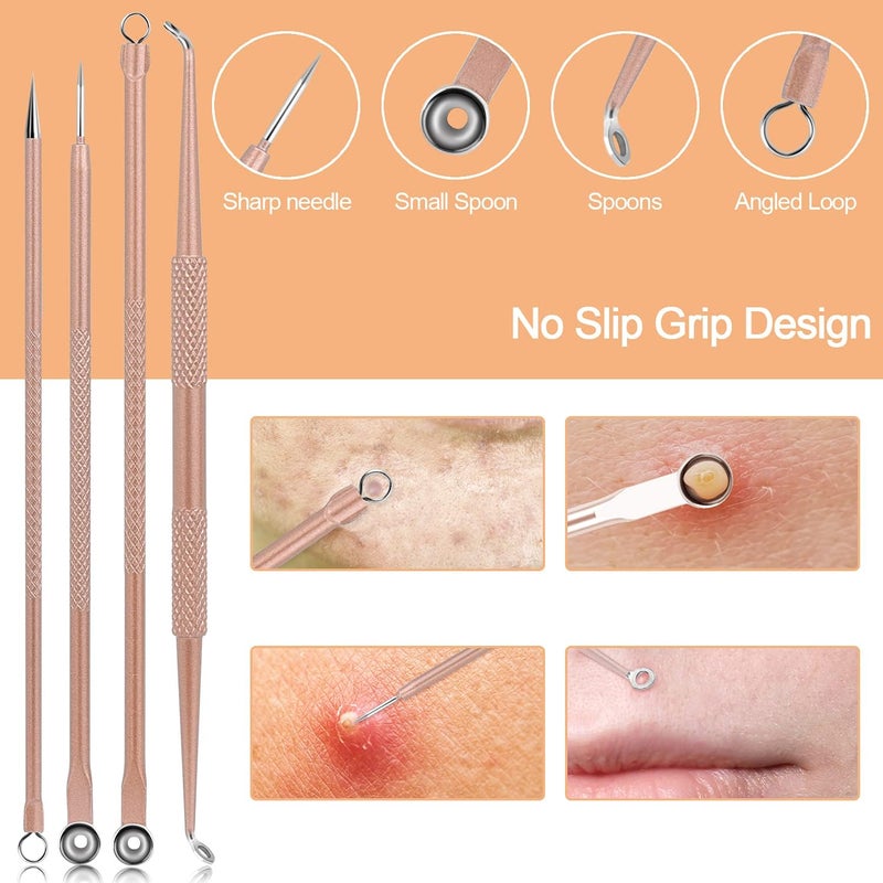 MENOLY Pimple Popper Tool Kit, 10 Pcs Blackhead Remover Comedone Extractor Acne Removal Kit for Blemish, Whitehead Popping,Zit Removing for Nose Face Tools with a Leather Bag (Rose Gold) - Image 4